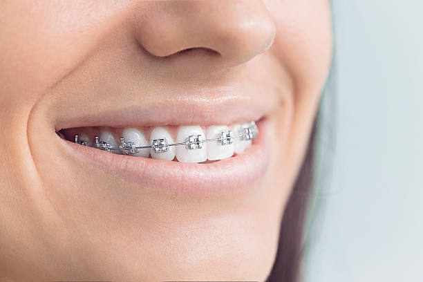 Best Full Mouth Reconstruction  in Riverdale, CA